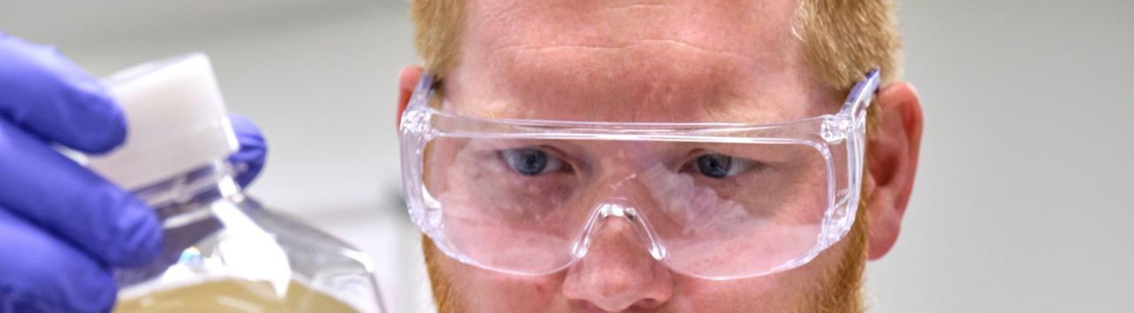High-Performance Liquid Chromatography (HPLC)